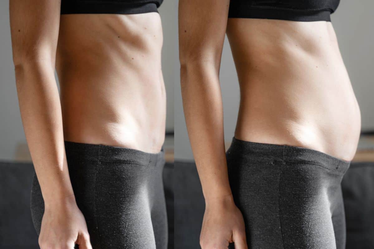 How long does diastasis recti take to improve Brentford?