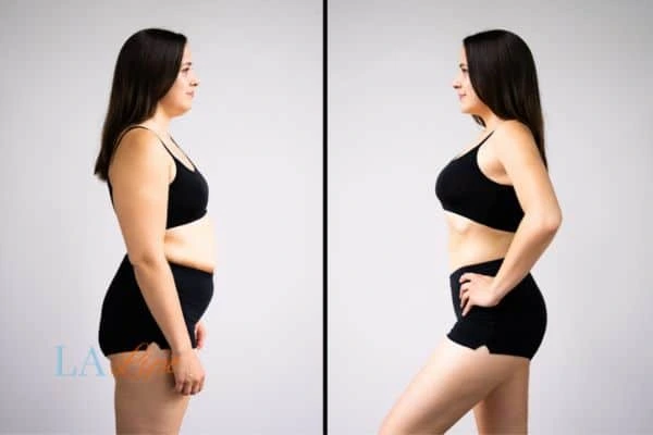 LA-EMS Body Sculpting Brentford results before and after of womans results on body toning.