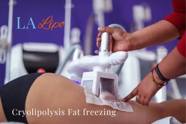 women getting fat freezing Brentford