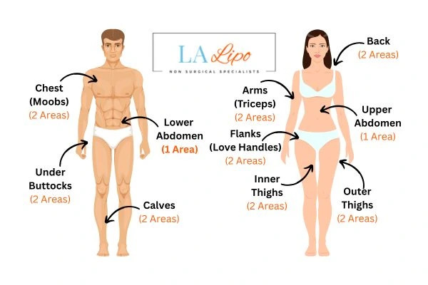 LA LIPO Cryolipolysis Areas Brentford