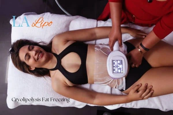 woman getting cryolipolysis Brentford