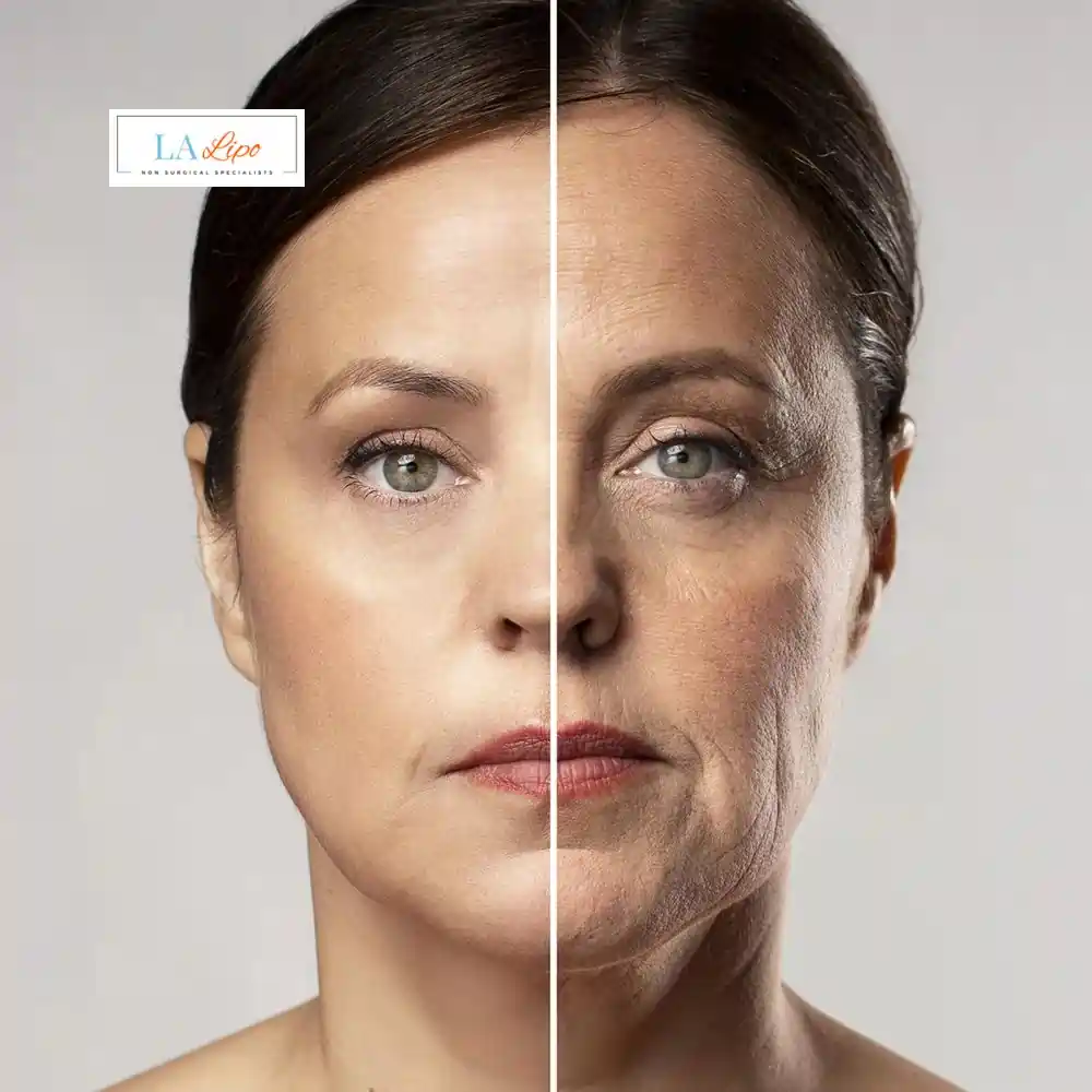 How Can You Tell If Non-Surgical Skin Tightening Is Right for You Brentford?