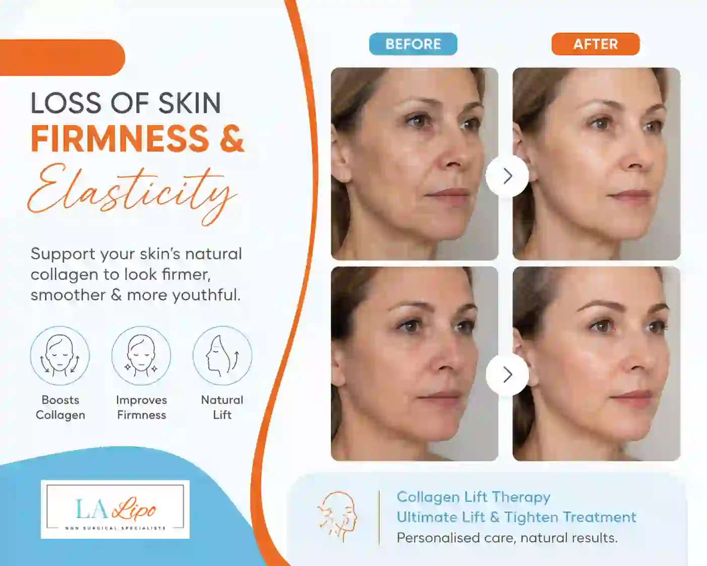 Sign #7: Loss of Skin Firmness and Elasticity Brentford