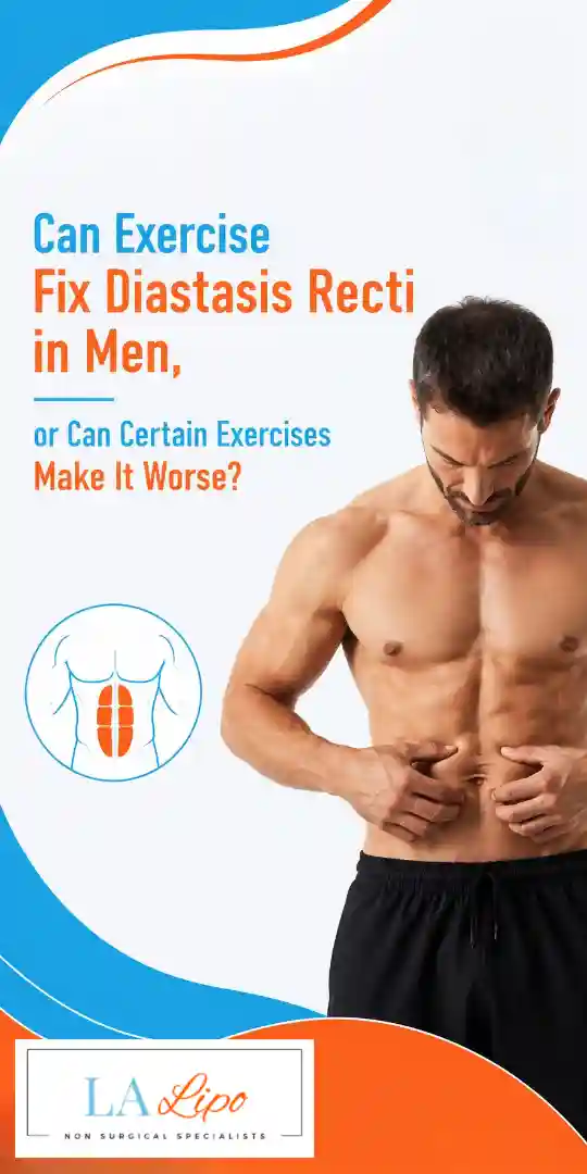 Can Exercise Fix Diastasis Recti in Men, or Can Certain Exercises Make It Worse Brentford?